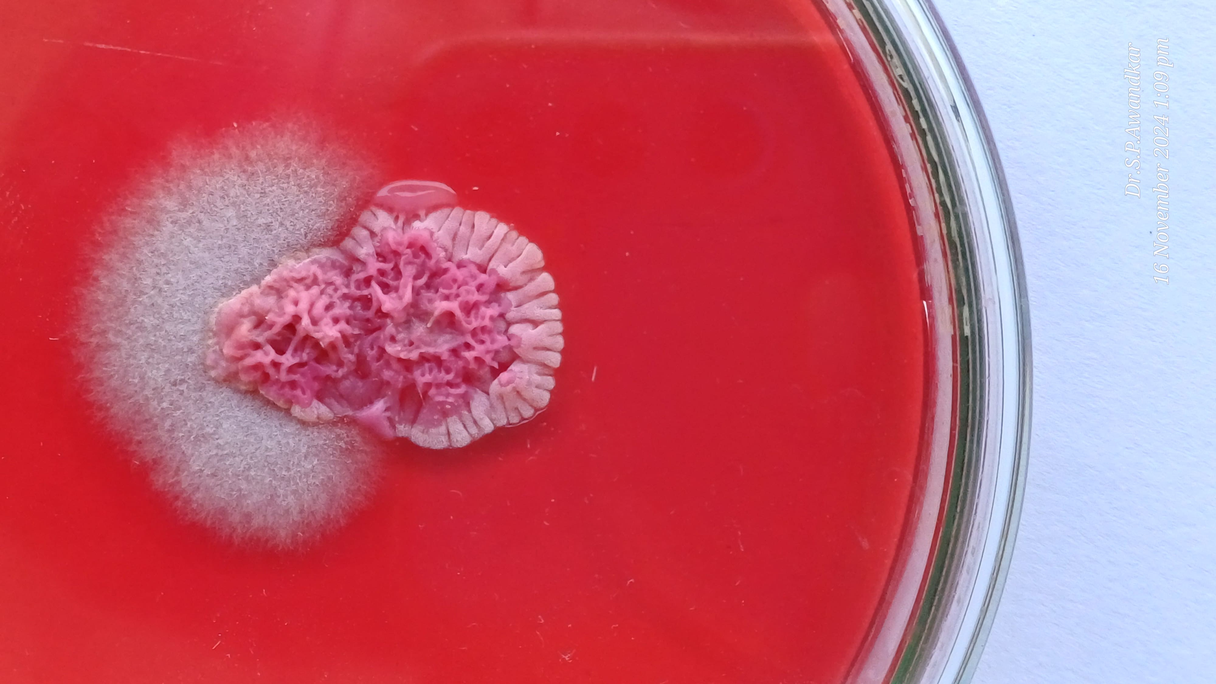 33. Trichophyton Rubrum